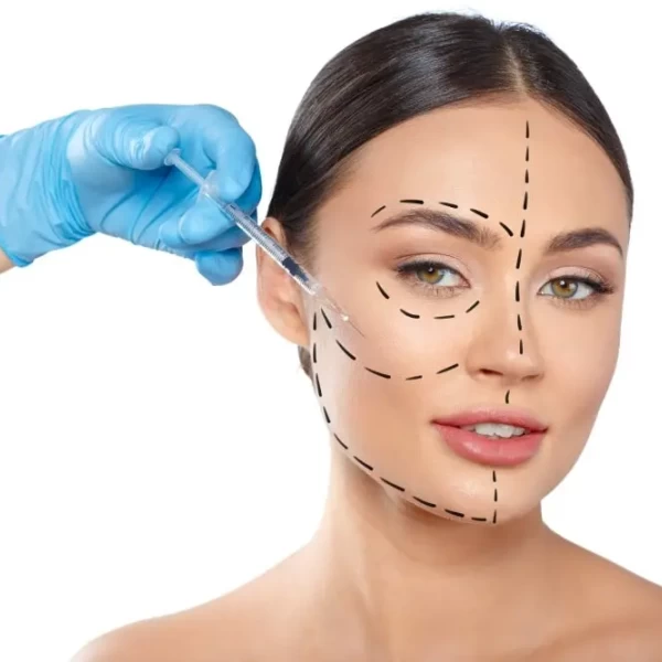 Masseter